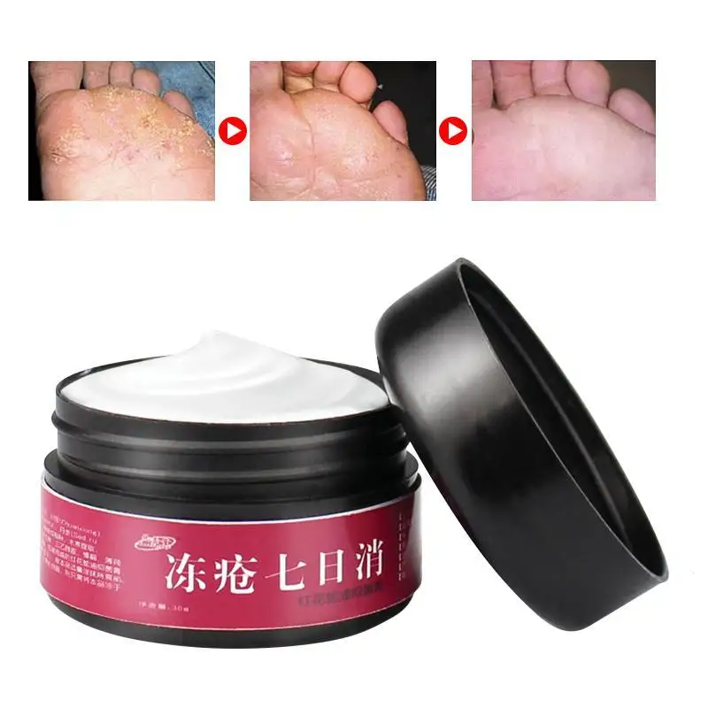 30g Foot Crack Cream Heel Chapped Peeling Dry Hand Repair Anti Foot Crack Ointment Cream Skin Repair Moisturizing Cream L3