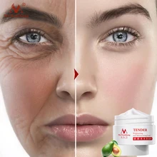 Подтяжка лица эссенция Красивая тайна нежный уход за кожей омолаживающий отбеливающий от морщин крем с гиалуроновой кислотой лосьон Ши