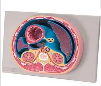 

Human Anatomical Cross Sectional Model of Abdominal Cavity Anatomy Peritoneal Transection Model Simulator Nurse Training Kit