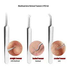 3 шт./компл. инструмент для удаления чёрных точек средства по уходу за кожей Красота инструменты Нержавеющая сталь Комедон акне экстрактор, пинцет Удаление прыщей иглы