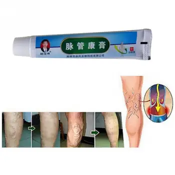 

20g Anti-acne For Phlebitis Treatment Herbal Ointment Chinese Herbal Medicine