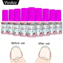 Yinikiz Масло для кутикулы увлажняющее увлажнение ногтей Лечение ногтей защита кутикулы масло для женщин макияж инструменты