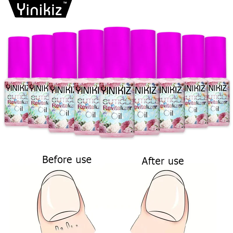 

Yinikiz Cuticle Oil Moisturizing Moist Nail Treatment Nail Cuticle Oil Protection Woman Make Up Tools
