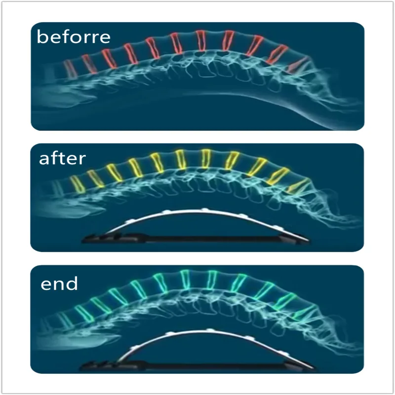 Магнитный массаж спины мышечный растягиватель Корректор осанки растягивающийся расслабляющий Поясничный поддерживающий позвоночник обезболивающий хиропрактический растягиватель