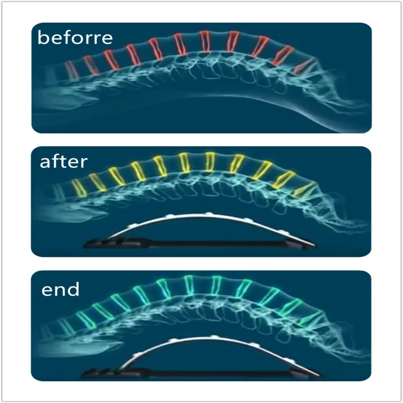 Cena Magnetyczny masaż pleców mięśni nosze korektor postawy Stretch Relax stabilizator lędźwiowy kręgosłupa ulga w bólu chiropraktyka nosze