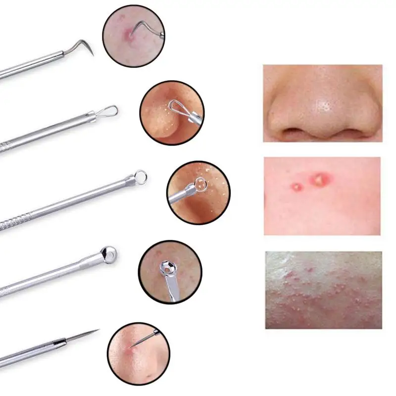 1/8Pcs Professional Blackhead Remover Tool Kit Stainless Steel Blackhead Acne Comedone Pimple