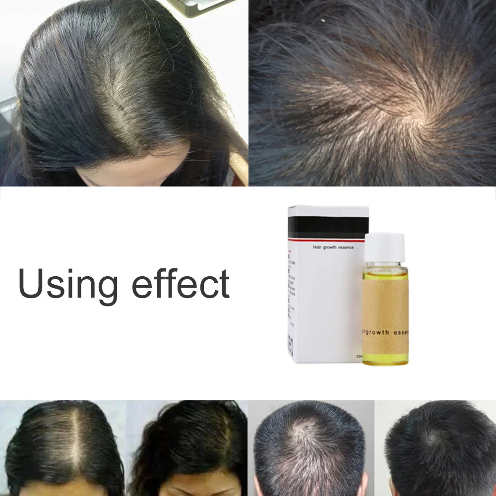 Средство товары для выпадения волос против выпадения волос 20 мл плотная быстрая рост Выжженных волос Essence Hair beauty
