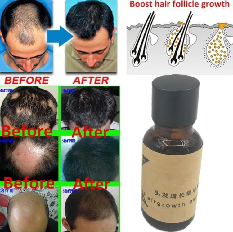 

Hair Growth Ginger Oil Natural Plant Essence Beard Eyelashes Growth Faster Grow Hair Ginger Shampoo Hair Loss Treatment