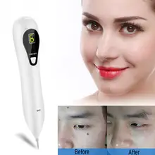 Lcd Pro моль карандаш для удаления веснушек Три регулируемые уровни пятна удаление татуировки очиститель пор бородавка инструмент для ухода за кожей bc