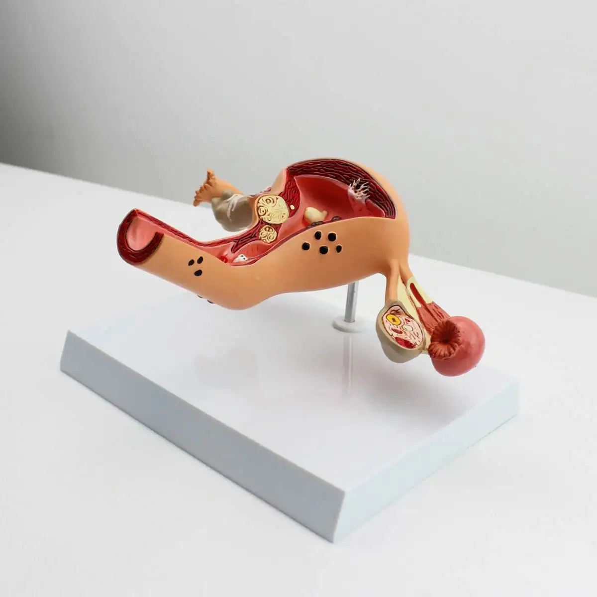 

Uterus Ovary Anatomical Model Common Pathologies Uterine Disease Ovarian Disease Ovarian Obstetrics Gynecology Teaching Mould