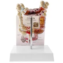 1: 2 человека большой Bowel патологическая модель медицинский анатомический модель для школьного обучения инструмент обучения дисплей лабораторные принадлежности