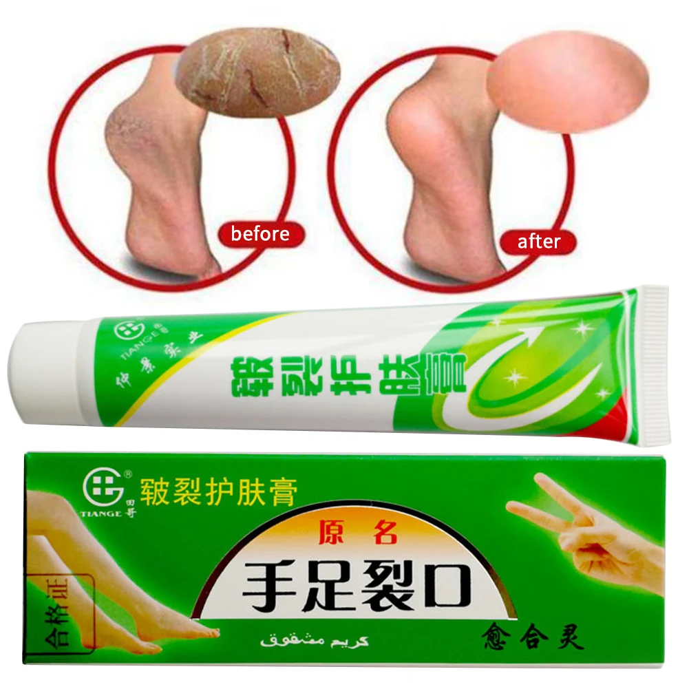 Рука ног ремонт трещины крем, мазь крем китайский лекарственный анти сухой трещины уход за кожей питательный Ageless 25 г