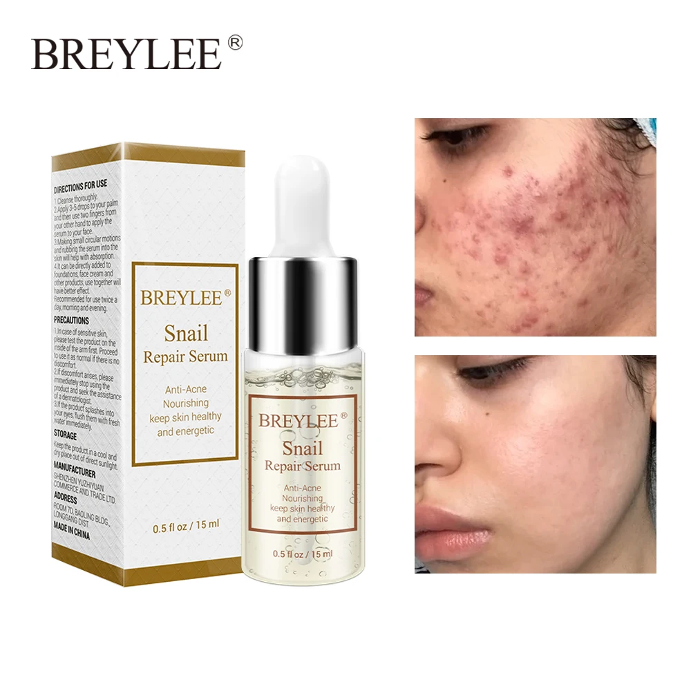 Breylee Snail Serum Collagen Serum Repairing Lifting Firming Essence Hyaluronic Acid Moisturizing Anti-aging Face Skin Care 1pcs Breylee Snail Serum Collagen Serum Repairing Lifting Firming Essence Hyaluronic Acid Moisturizing Anti-aging Face Skin Care 1pcs
