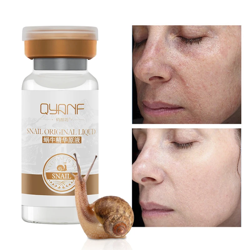 

QYF Snail Essence Hydrating Moisturizing Acne Removing Blackhead Anti-aging Shrink Pores Whitening Facial Serum Skin Care