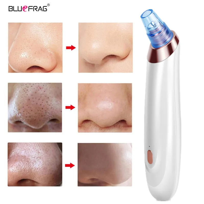 Pimple Tool Remover Blackhead Vacuum Acne Cleaner Pore USB Rechargeable