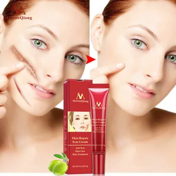 

Scar Removal Cream Skin Repair Acne Spots Treatment Anti Scar Stretch Marks Face Cream Blackhead Whitening Cream Body Care