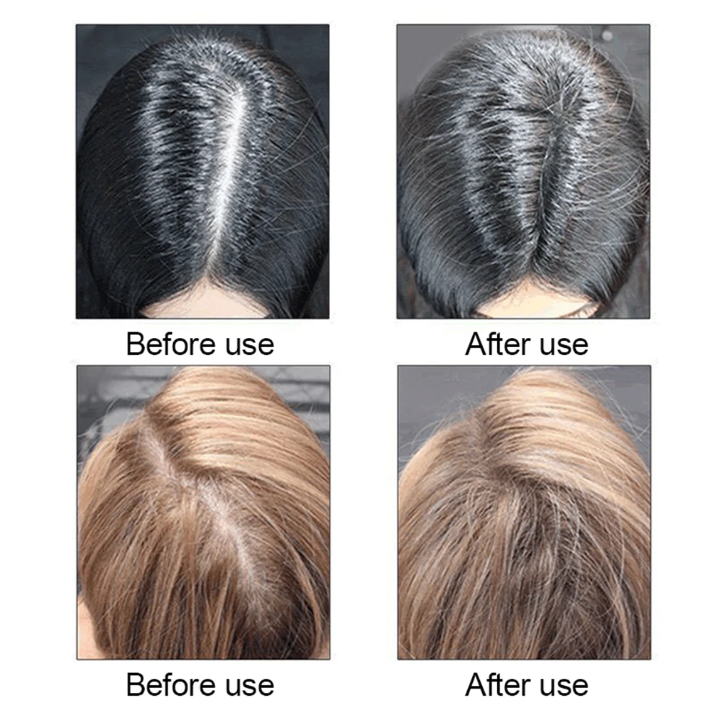 Кератиновые Волокна Для Волос Купить