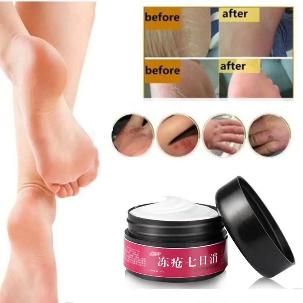 

VIBRANT GLAMOUR Foot Hand Anti Dry Crack Ointment Skin Repair Moisturizing Cream