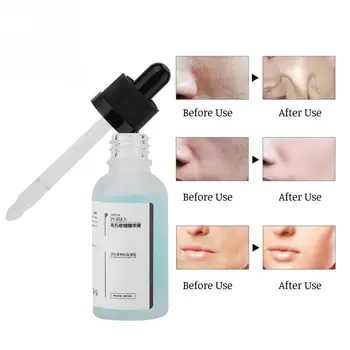 

30ml Skin Pore Shrinking Essence Face Repairing Moisturizing Firming Serum Pore Treatment a