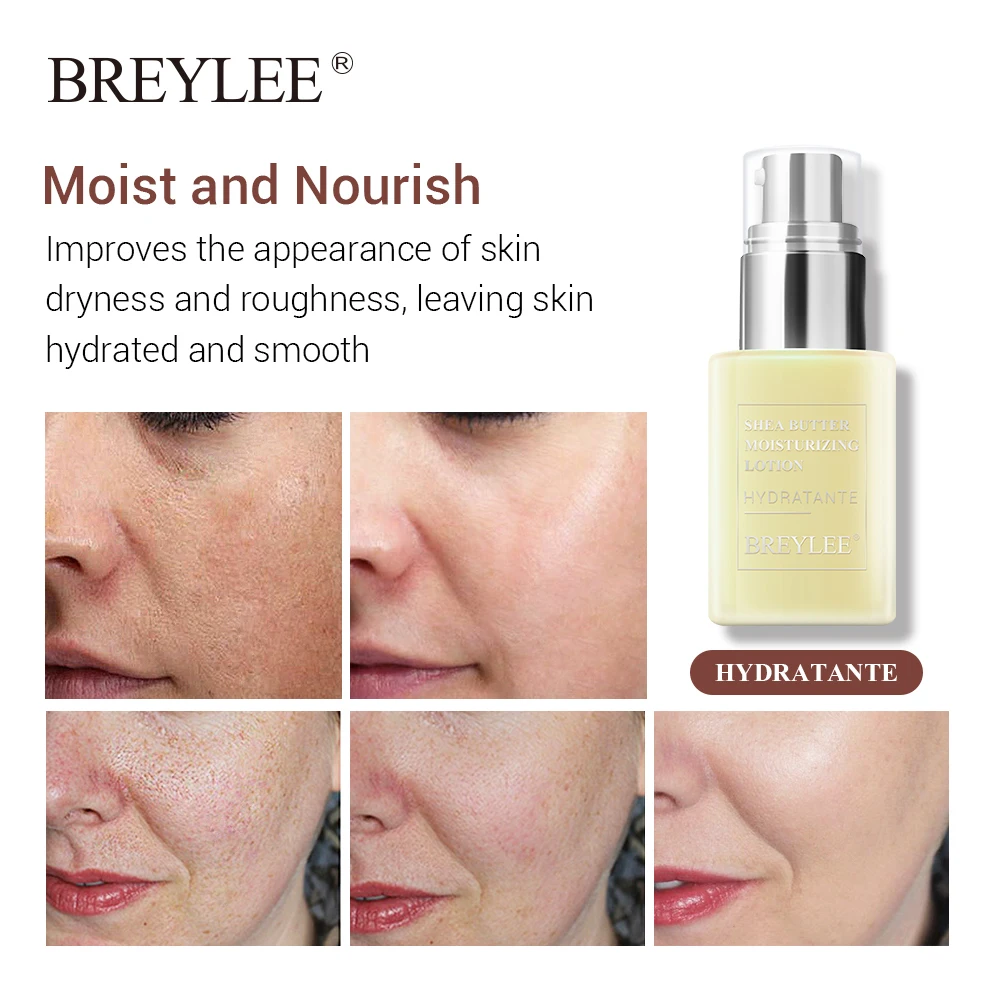 Breylee Face Cream Shea Butter Moisturizing Lotion Skin Care Anti Acne Treatment Facial Emulsion Easy To Absorb Day Night Cream