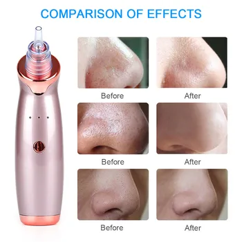 

Hot! Pro Electric Blackhead Vacuum Remover Skin Care Beauty Machine Inhaler Spot Acne Pore Cleaner Facial Cleanser Kit