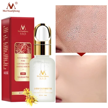 

MeiYanQing Hamamelis Pore Shrinking Essence Effectively Clean Pore Exfoliator Whitens Skin Replenishes Skin Moisture Shrink Pore