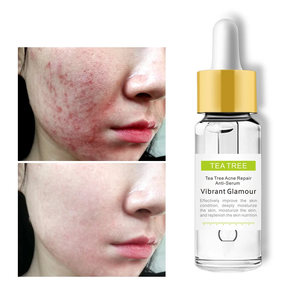 

VIBRANT GLAMOUR Tea Tree Repair Face Serum Acne Scar Shrink Pores Eliminates Acne Treatment Oil Control Essence Face Serum