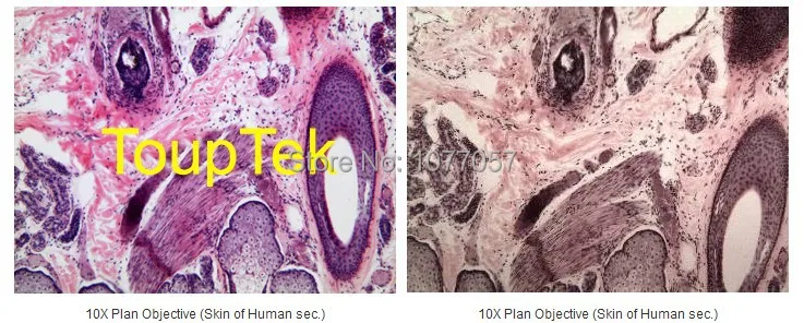 Прямая с фабрики CE ISO1600X Расширенный Trino Darkfield микроскоп с 3.1m Пиксельная камера, высокое качество для лабораторного, больничного использования
