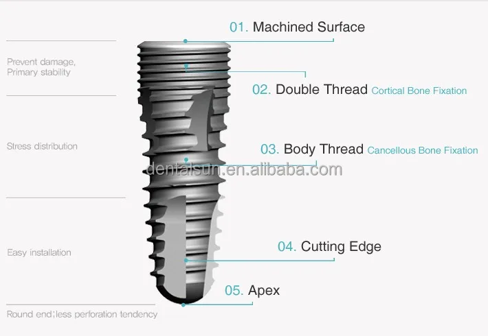 Стоматологические хирургические титановые имплантаты/DIO стоматологические имплантаты