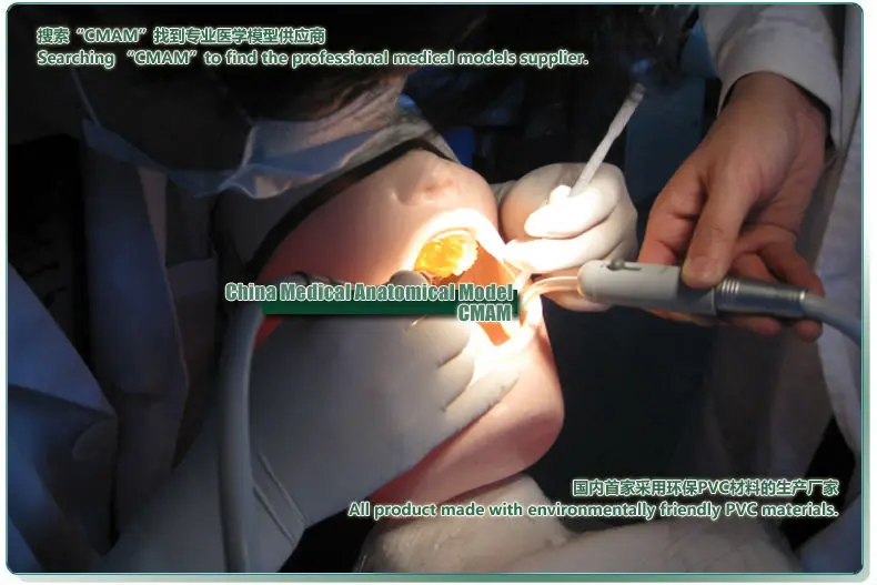 CMAM/12603 стоматологические кариес у детей, человеческие стоматологические медицинские анатомические модели обучения