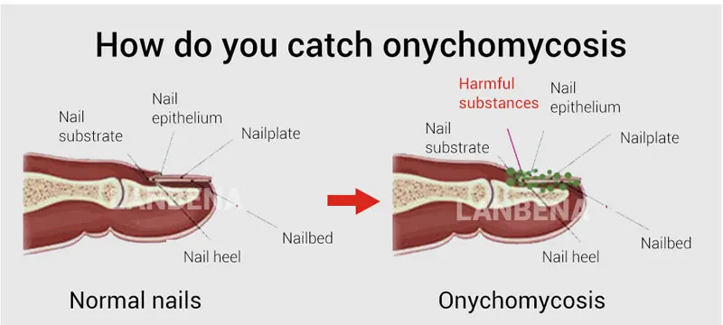 nail-repair-essence-1_02