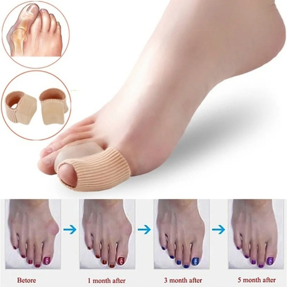 1 pc High Elastic Toe Finger Straightener Hammer Toe Hallux Valgus Corrector Bandage Toe Separator Foot Care Bandage Dropship