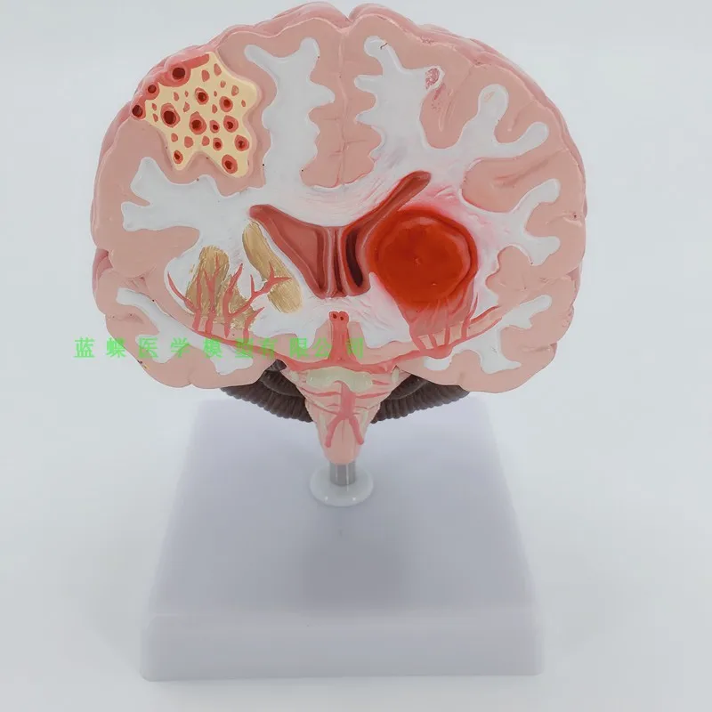 

Human brain anatomy, brain/stroke models,brain congestion brain disease models