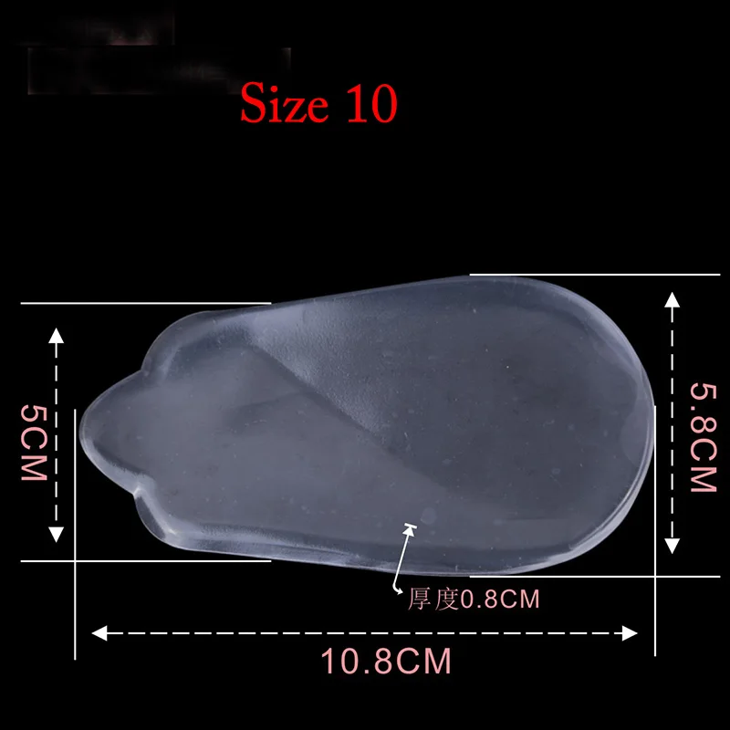 XO-1