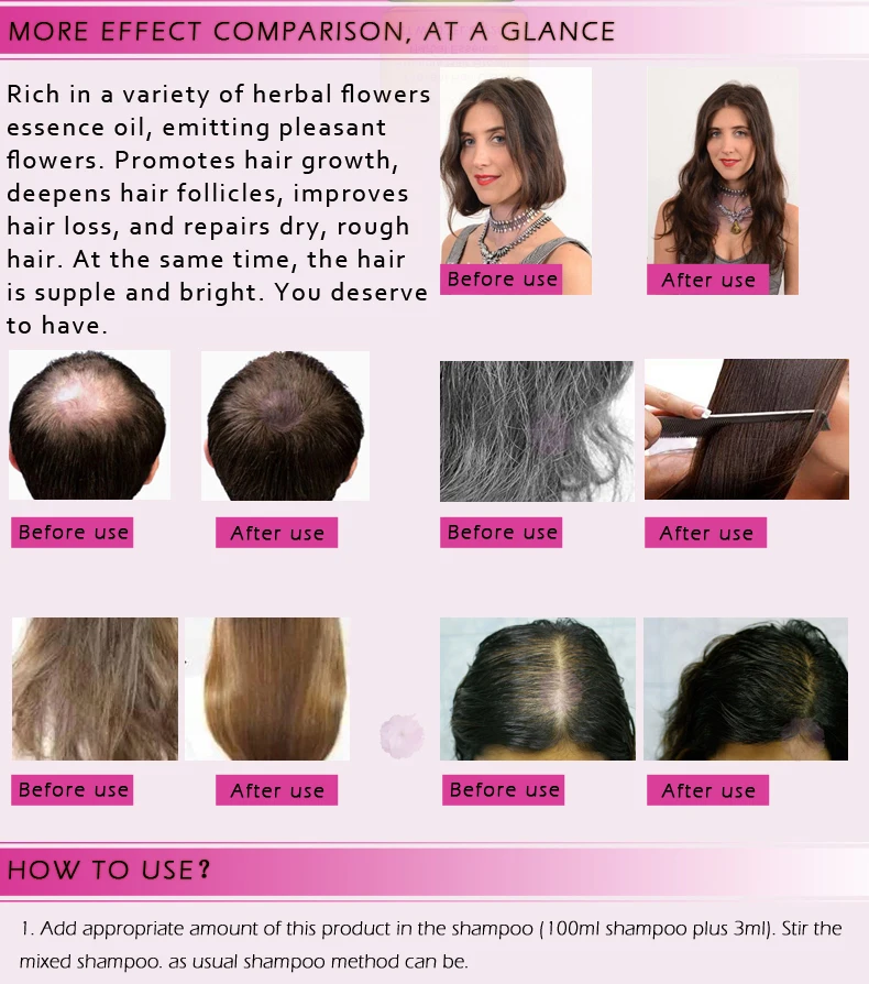 RtopR эссенция для роста волос быстро мощные продукты жидкое эфирное масло лечение Предотвращение выпадения волос уход за волосами парикмахерские 20 мл