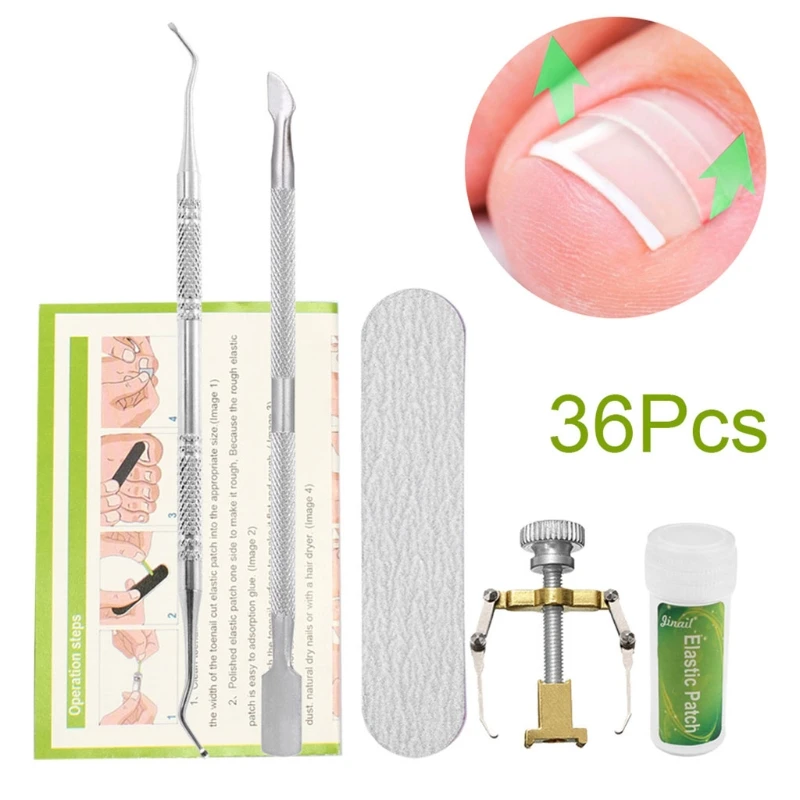 

5Pcs/Set Ingrown Toe Nail Correction Tool Paronychia Recover Fixer Patches Treat