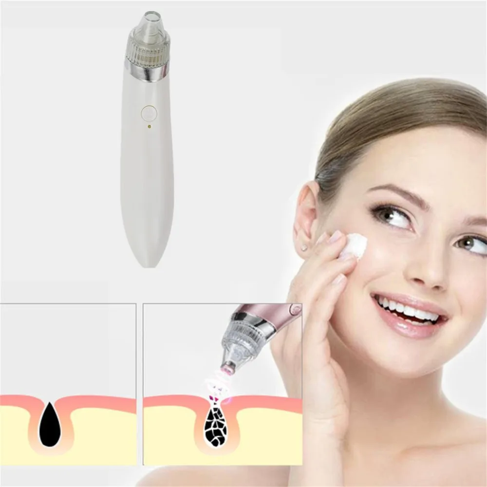 New Blackhead Remover Tool 1pc Electric Facial Skin Care Pore Blackhead ...