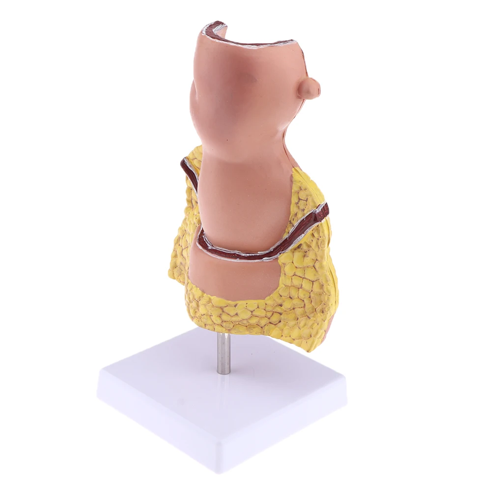 5x Pathological Rectum with Anus Hemorrhoid, Human Anatomical Model Anorectal Diseases Learning for Student Teacher Acss