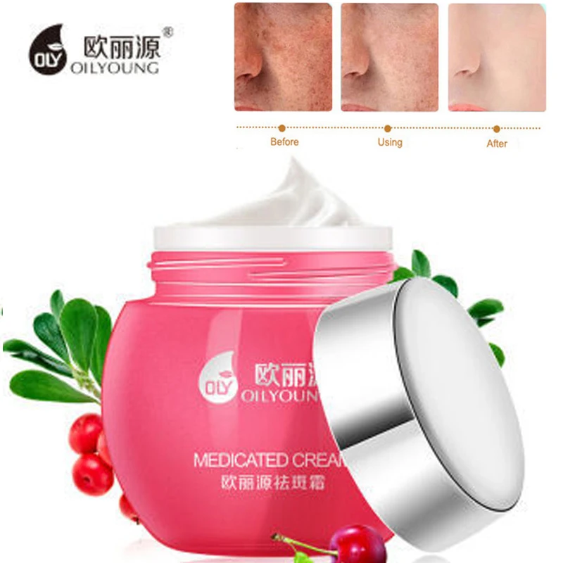 

Remove Freckle Cream Anti Wrinkle Anti-Aging Whitening Firming Moisturizing Hydrating Melanin Spots Removal Beauty Skin Care