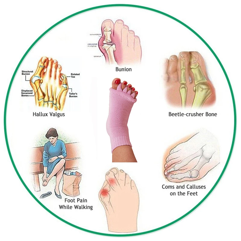 1 пара носки с пятью раздельными пальцами Bunion корректор ортопедические разделители для вальгусная деформация первого пальца стопы боль облегчение ухода за ногами педикюр инструменты