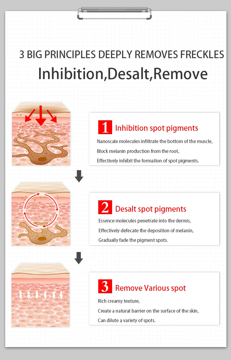 Корейский отбеливающий крем с сильным эффектом для удаления веснушек для лица уменьшает пигментные пятна выцветание темных пятен Сыворотка для лица 30 г