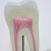 Один яркий Зуб Модель стоматологическая клиника Украшения Специальные украшения на заказ статуэтки для медицинской школы