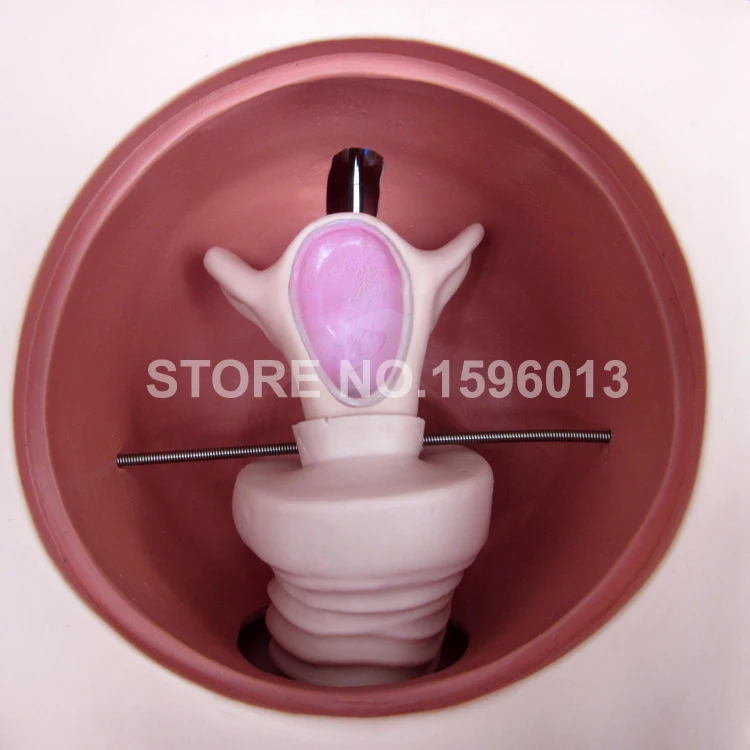 T33B contraception model (5)