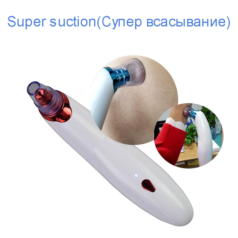 Blackhead-819-6