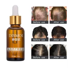 Средство для роста волос Жидкое быстрое естественное лечение выпадения волос Эфирное Масло жидкое лечение от выпадения волос Уход