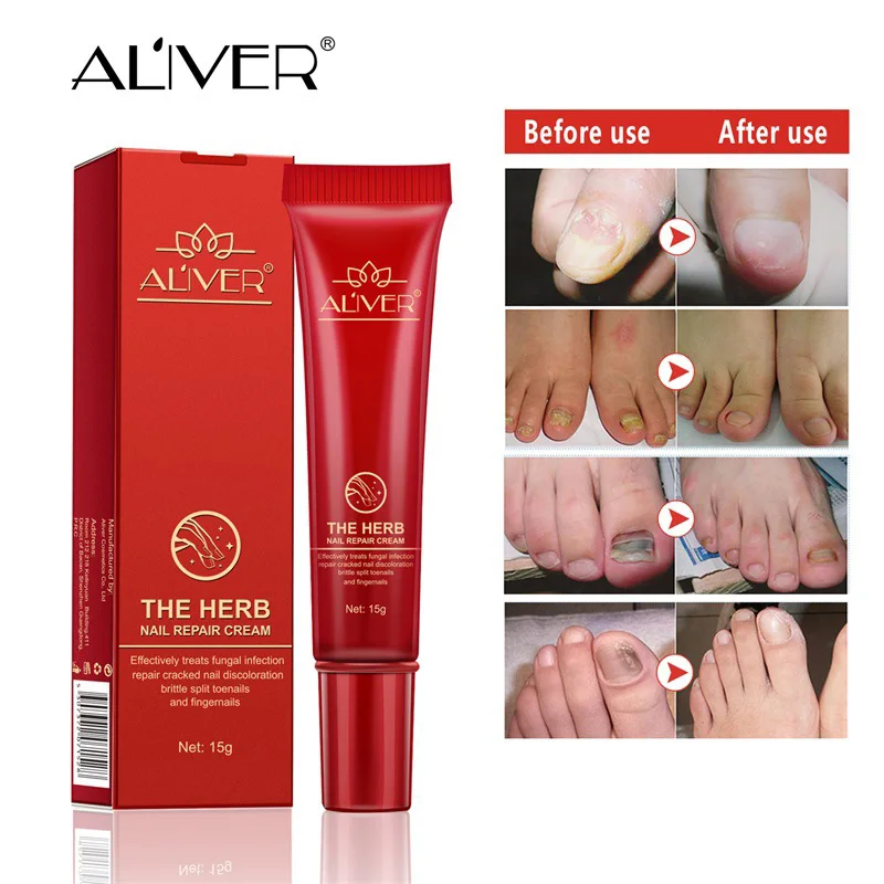 

Hot sale Nail Repair Cream Nourishing Herb Fingernail Care Treatment Striking Ointment