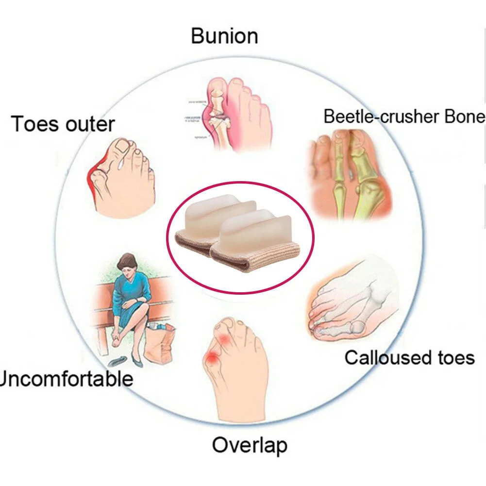 Силиконовый фиксатор для коррекции вальгусной деформации пальцев ног, сепаратор пальцев ног, уход за ногами, ортопедические стельки, эффективный выпрямитель, многоразовый
