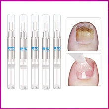 1/3/5 шт.-3 мл!! противогрибковые лечения Ногтей ручка онихомикоз паронихии инфекции травяные палец ногтям здоровье Красота аксессуары