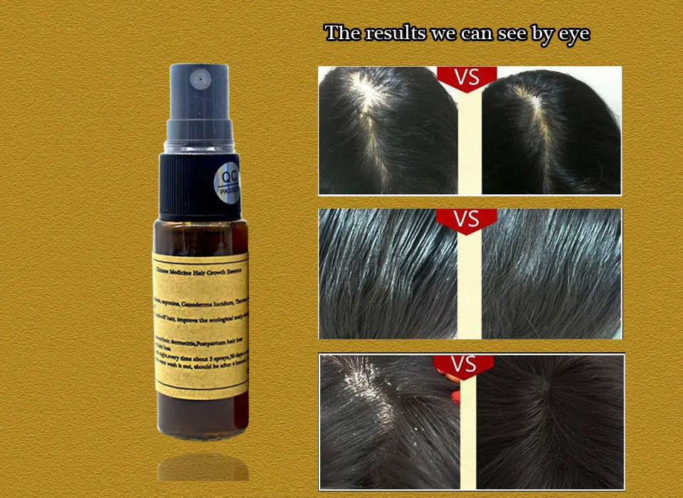 Лучшая китайская медицина, сыворотка для восстановления волос Yuda Pilatory, эссенция для быстрого роста волос, жидкое средство против выпадения волос