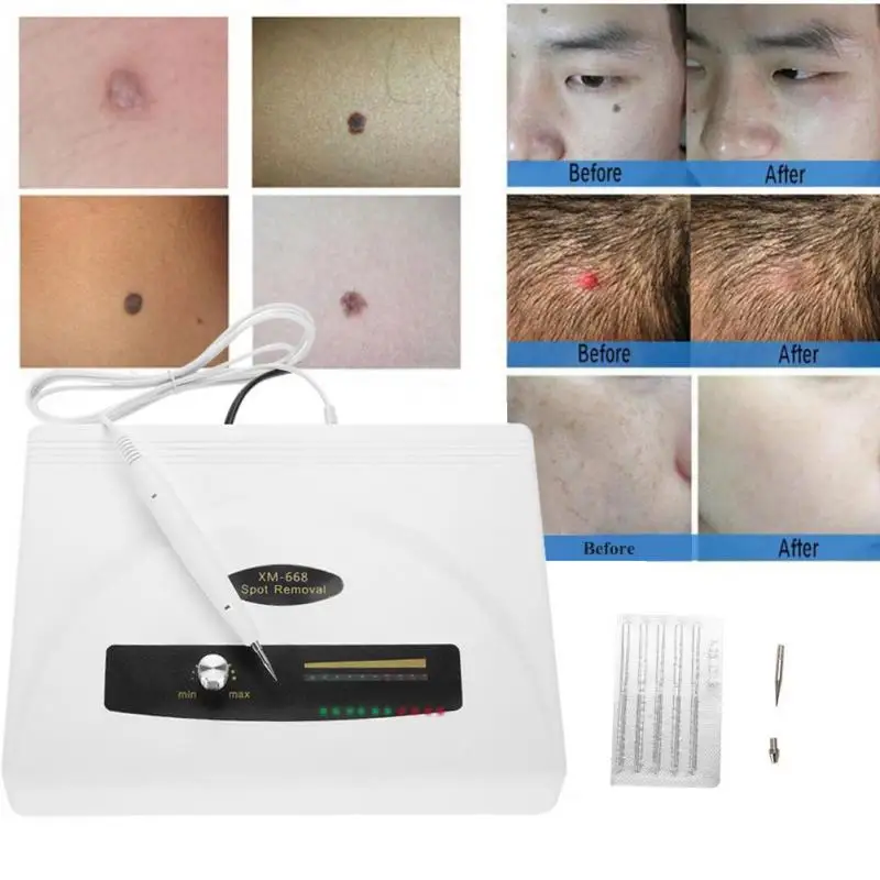 

Ultrasonic Dark Spot Removal Pen Freckle Tattoo Mole Removal Plasma Wart Remover Pen Home Spa Face Body Beauty Skin Care Machine